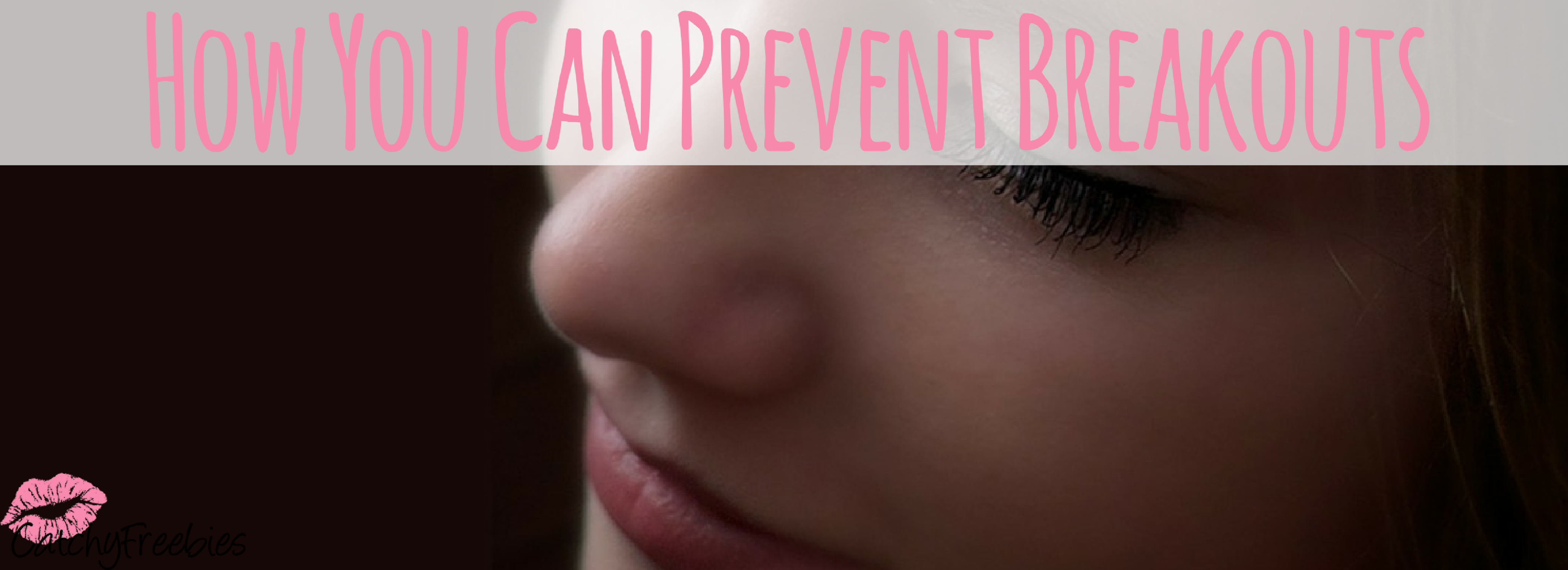 How You Can Prevent Breakouts